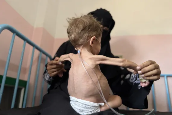 Famine Officially Declared in Gaza City